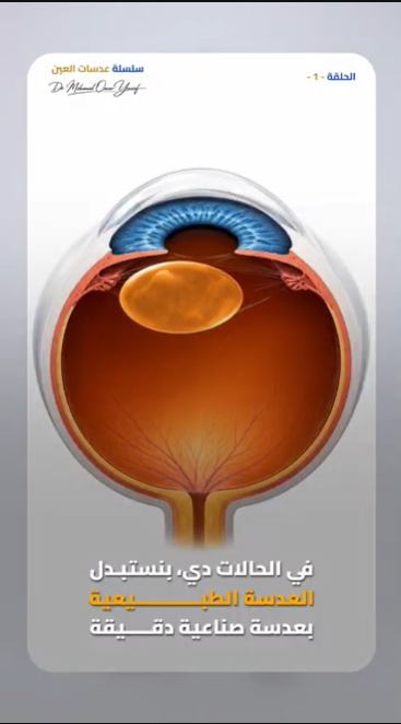 Reference frame showing an illustrated eye anatomy b-roll inside a rounded-corner card, centred in the frame.